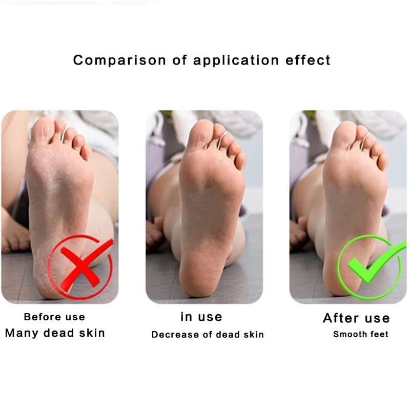 Инструмент для педикюра 4 в 1 многофункциональный инструмент пемзы домашнего