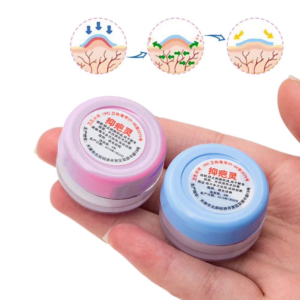 Розовый синий эффективные растяжки удаление шрамов акне крем от хирургический