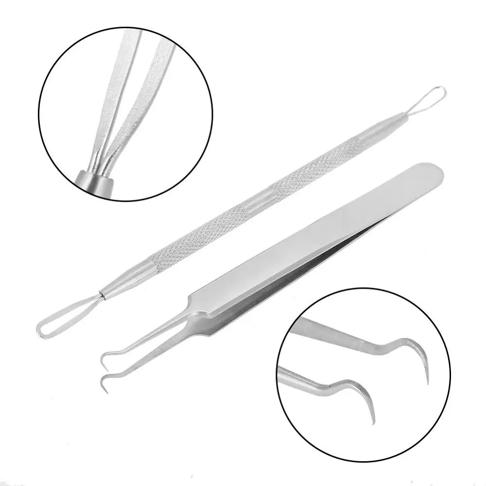 2 шт./компл. Нержавеющая сталь черноголовых удаления набор инструментов