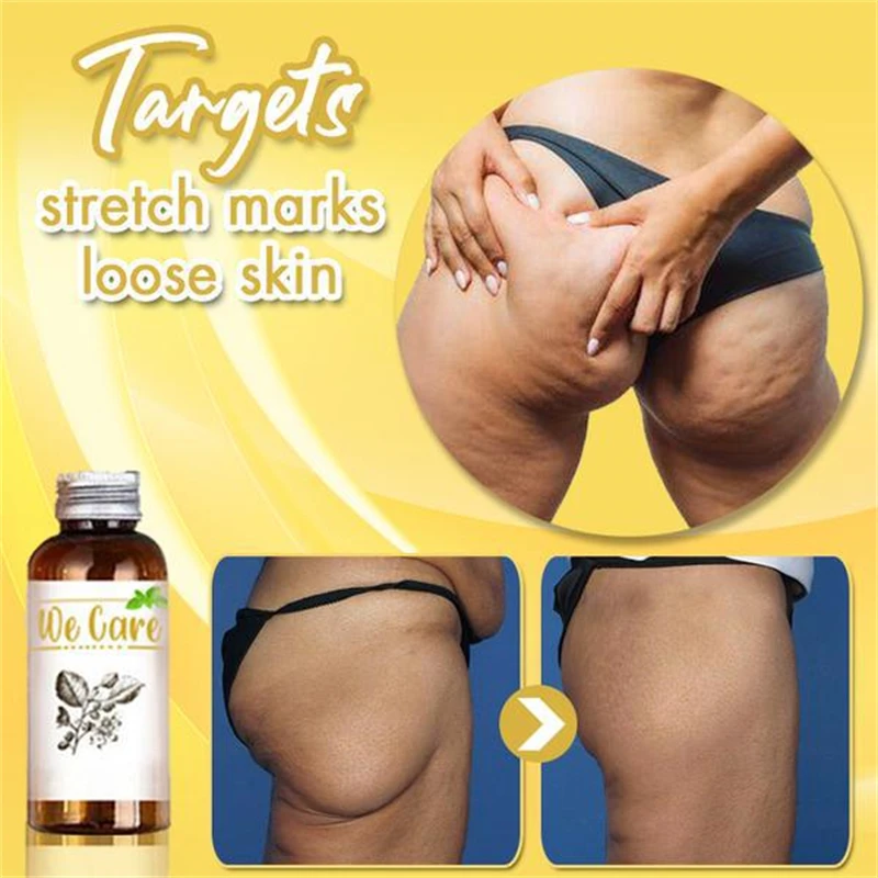 

30ml Natural Herbal Slimming Massage Oil Organic Body Waist Shaping Lose Weight Essential Oil Weight Loss Slimming Oil