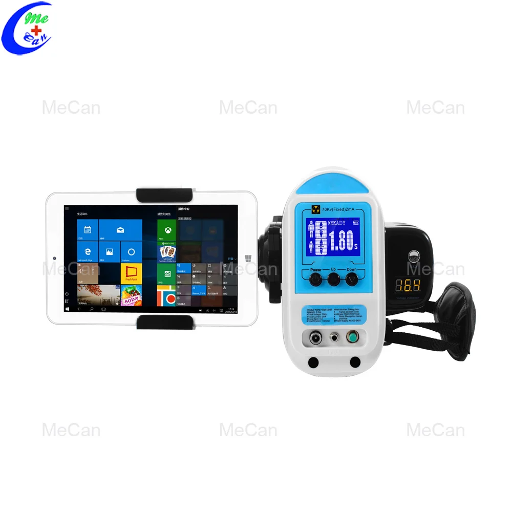 

Hot sale high quality Plus portable X-ray machine / dental X-ray sensor