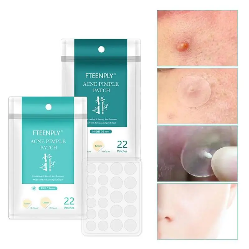 Накладки для прыщей от акне невидимые наклейки лечения маска лица средство