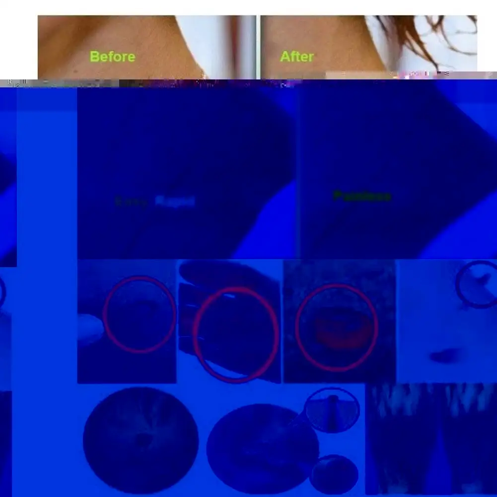 

10Ml Skin Tag Remover Genital Warts Treatment Instant Mole Repair Remove Tool Corn Foot Bacteriostatic & Liqu Papillomas Na E0V0