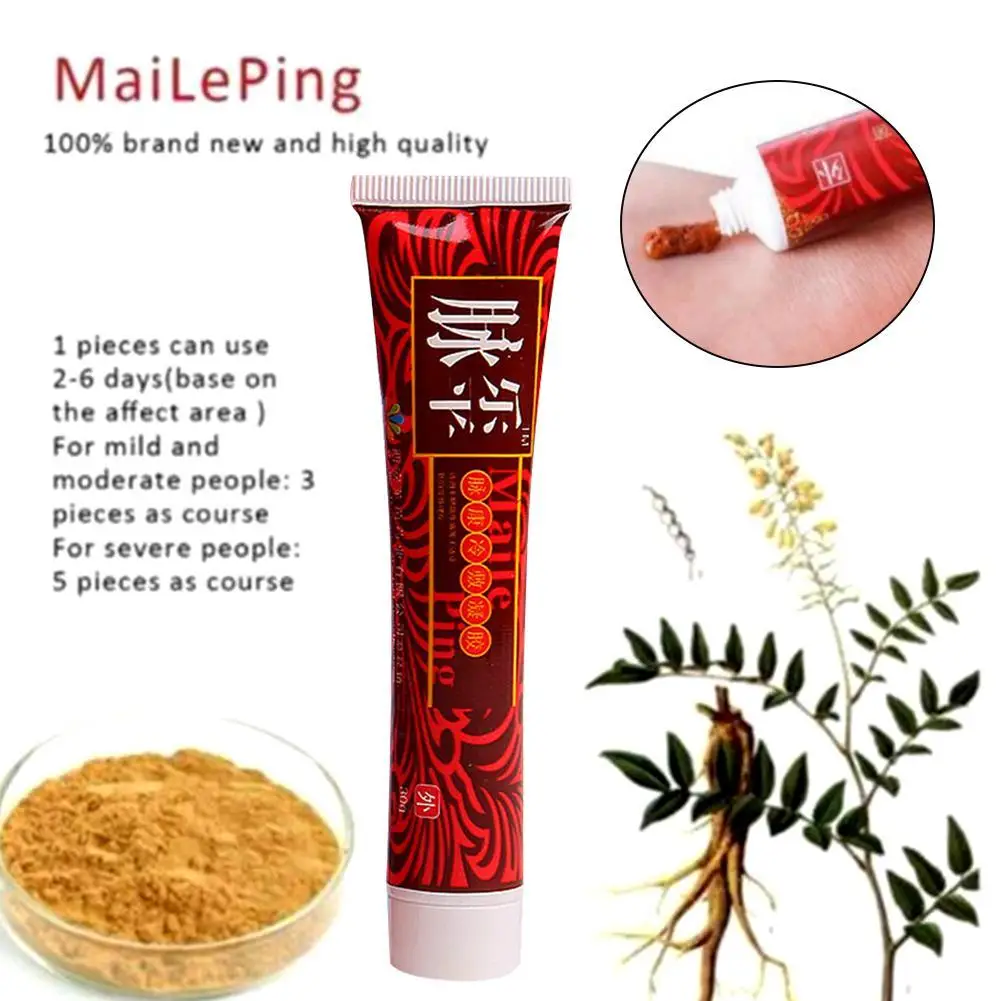 Varicose Veins Treatment Cream Effective Vasculitis Phlebitis Spider Varicosity Angiitis Ointment Herbal |