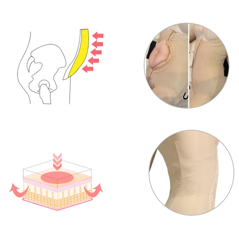 IDEALSLIM/лечебные компрессионные колготки брюки после липовсасывания для коррекции