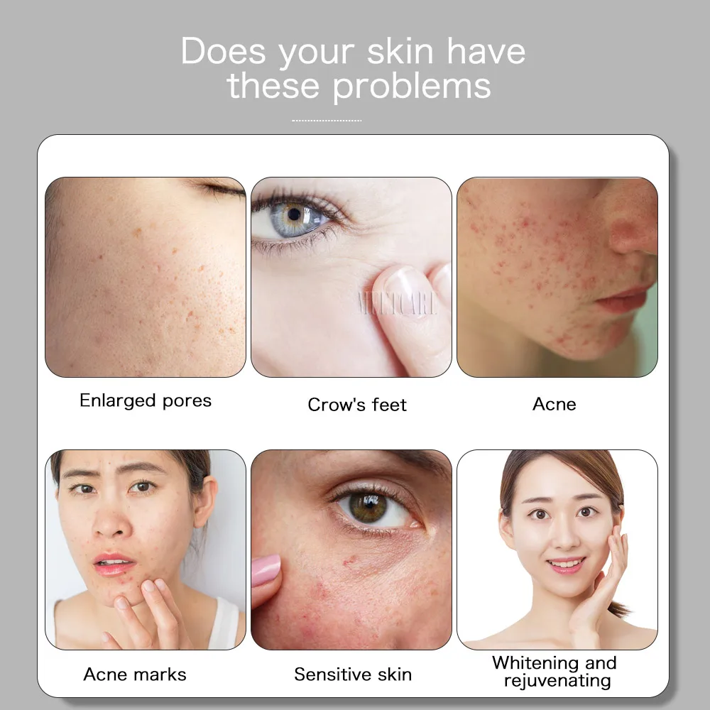 M5 Derma ручка Dr. Pen Microneedle байонет набор игл Микро прокатки Дерма штамп морщин