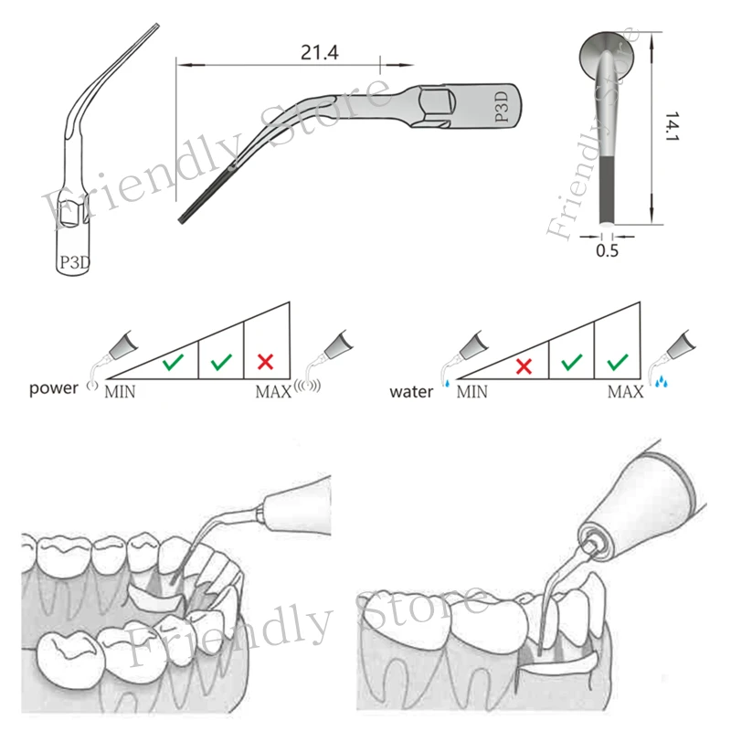 Рисунок 4 - VV Dental P3D ультразвуковой скалер