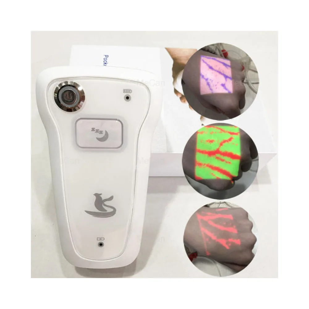 

Handheld Vein Viewer Vein Finder Vein Viewing Equipment