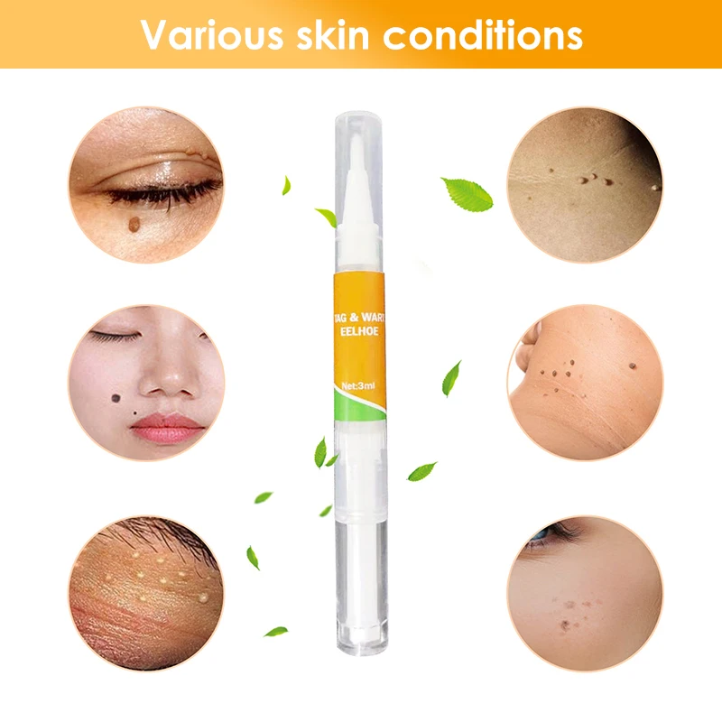 1/2/3 шт. кожу средство удаления бирок половых органов для борьбы с пигментацией