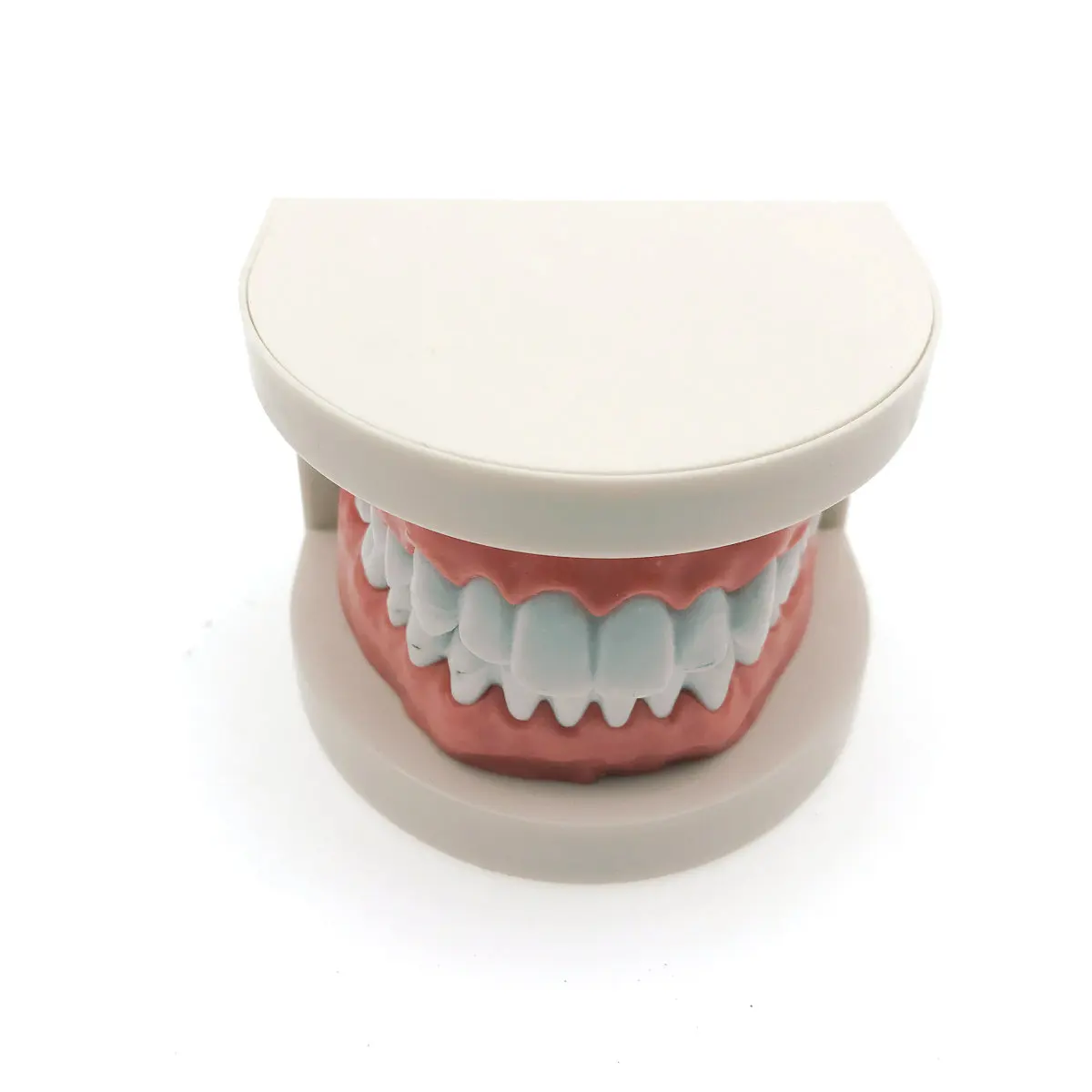 Модель для обучения стоматологии кариеса модель демонстрация размер