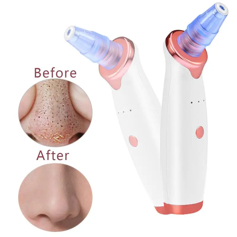 

Facial Pore Nose Blackhead Vacuum Suction Machine Blackhead Remover Peeling Pore Cleansing Face Skin Deeply Cleaner