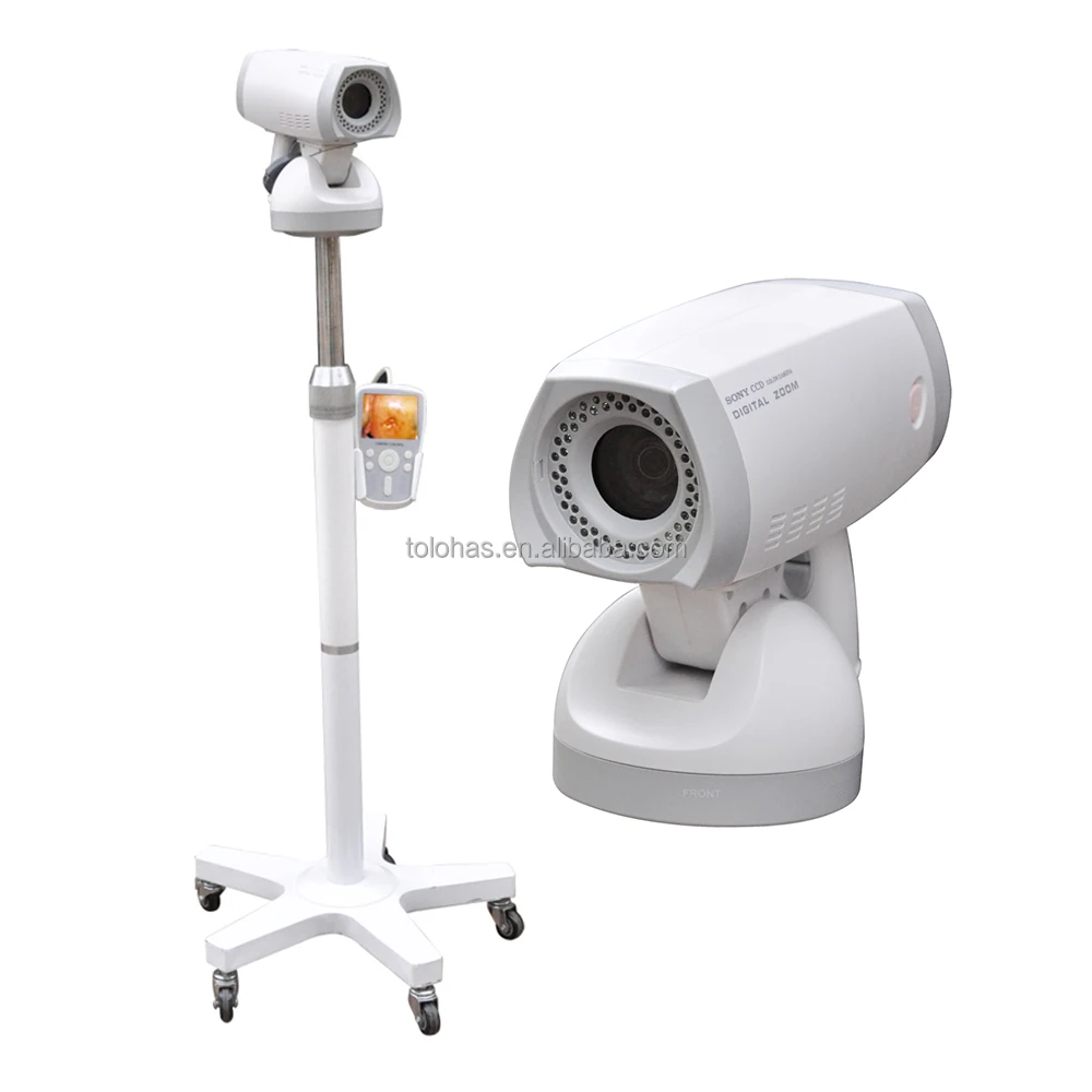

LH9800A Hospital Video Colposcope Camera Gynaecology Optical Electronic