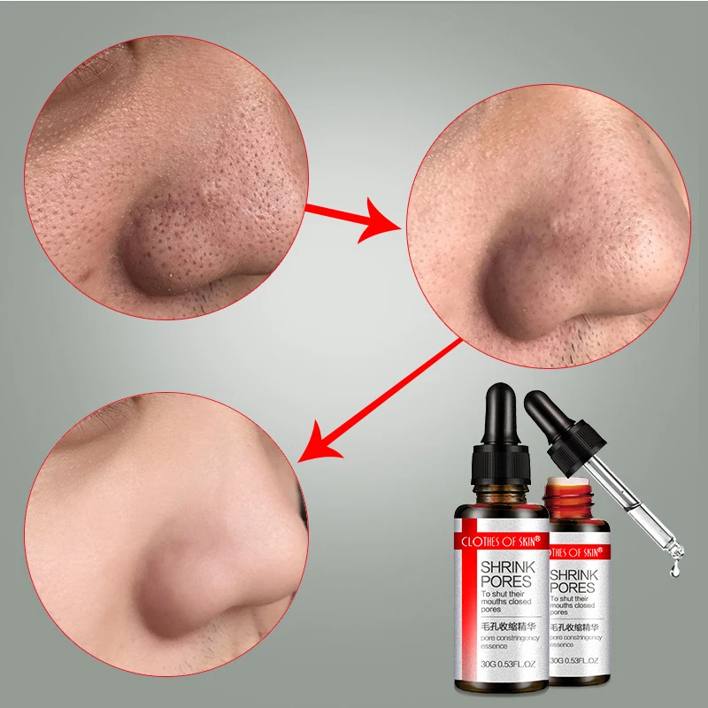 

Hyaluronic Acid Shrink pores Essence Blackhead Remover Acne Treatment Oil-control Whitening Serum Moisturize lighten Skin Care