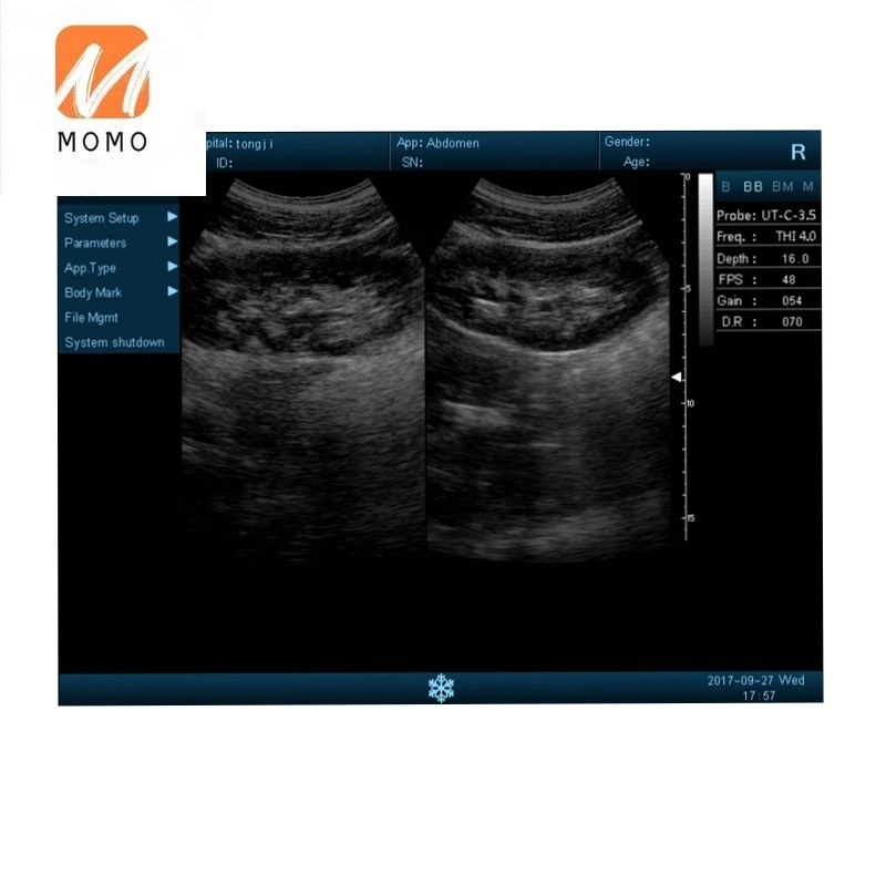 Оригинальная ультразвуковая система для диагностики лошадей с дешевой ценой.