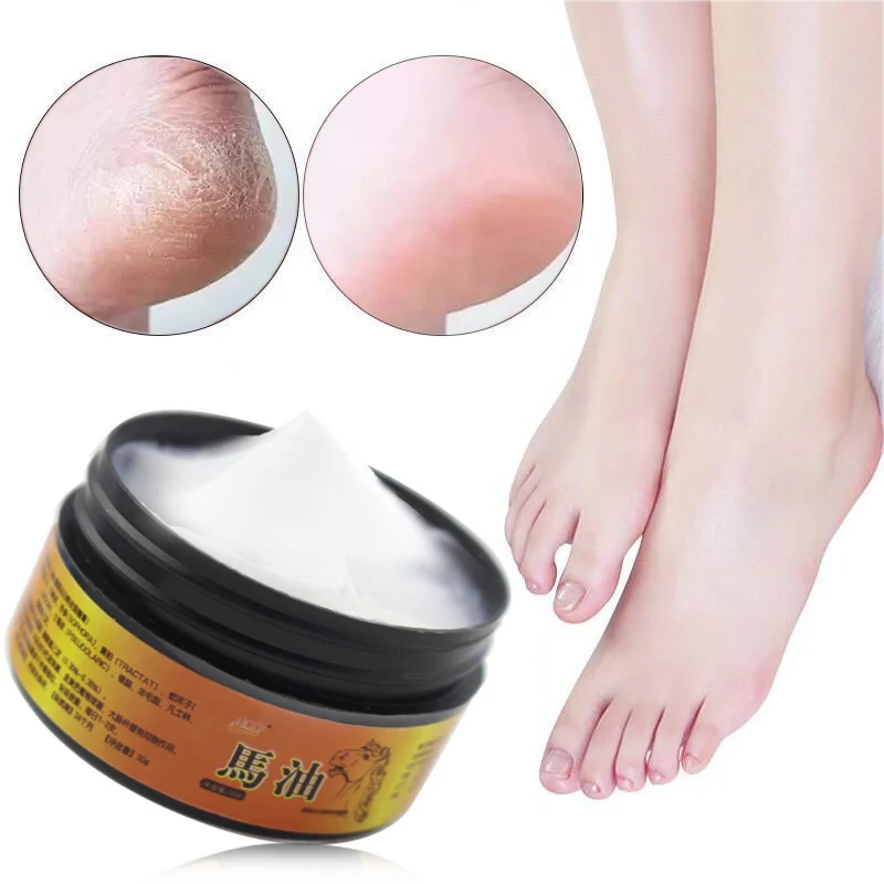 Уход за кожей конского масла крем для ног анти Потрескивающий пилинг