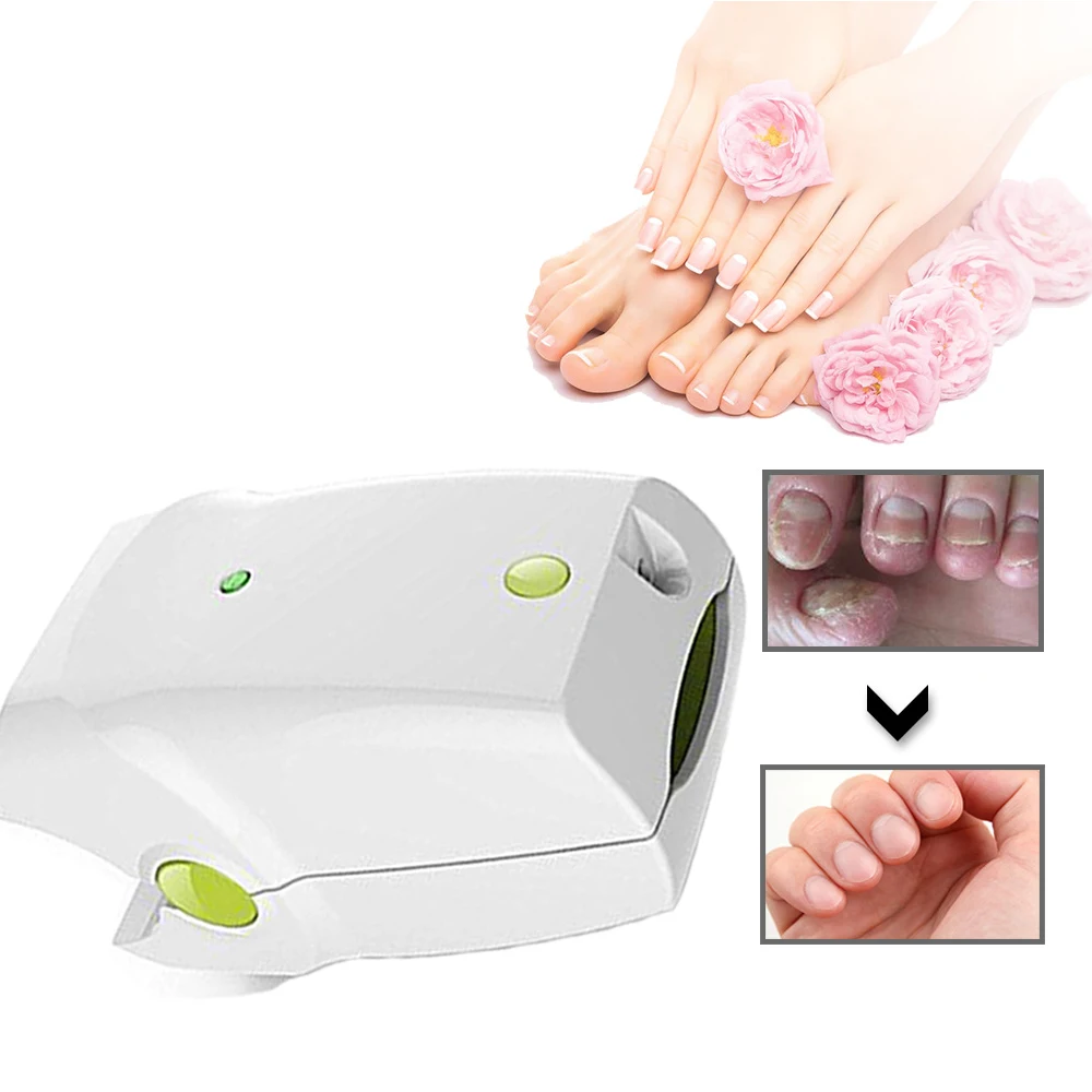 Перезаряжаемое устройство для лечения грибка ногтей онихомикоза