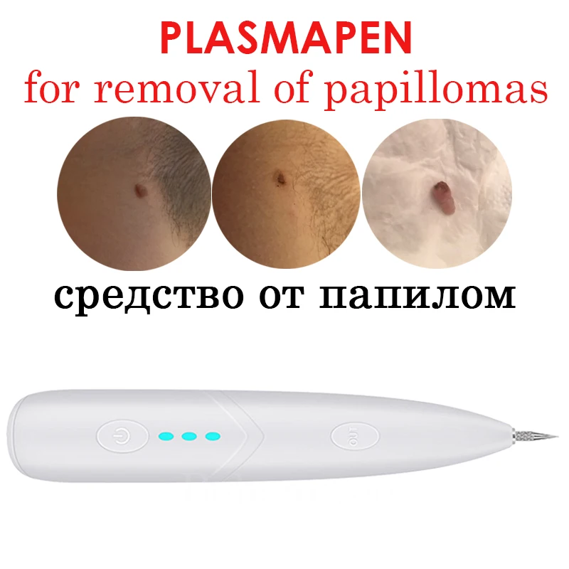 Плазменная ручка Plazma устройство для избавления от бородавок пластмассы Black Spot
