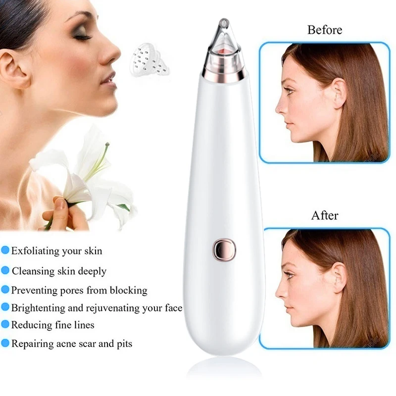 Средство для удаления черных точек вакуумное оборудование косметический