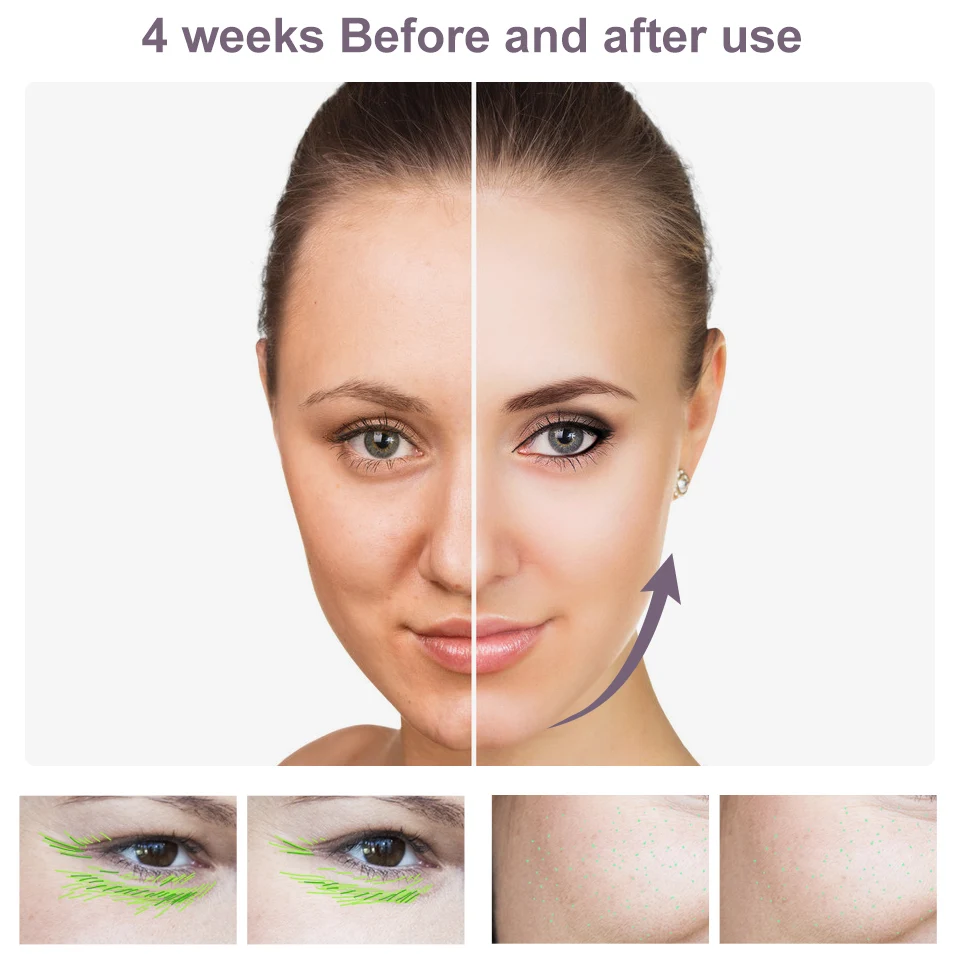 AmazeFan Beauty Device RF EMS Mesotherapy Electroporation Face Radio Frequency LED Photon Skin Rejuvenation Tightening |