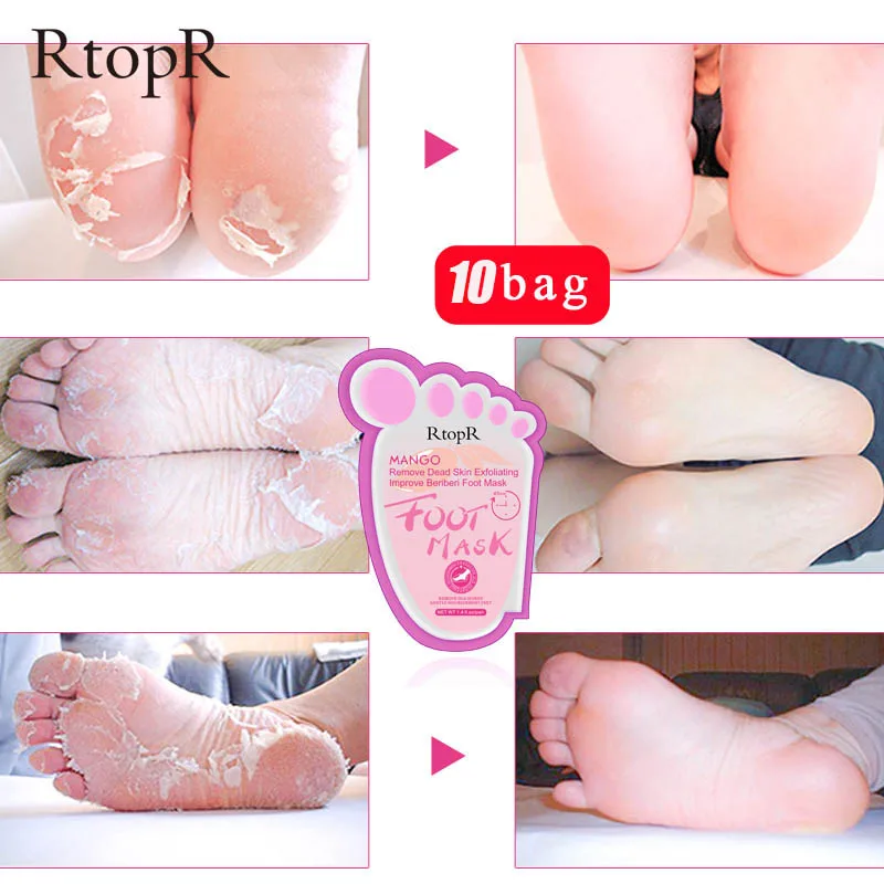 10 пакетов маска для ног отбеливающий Отшелушивающий увлажняющий отшелушивающий