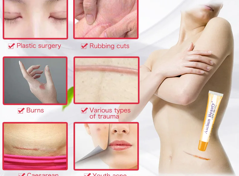 Aichun крем для ухода за кожей после родов прыщей лица светильник TSLM2 | Красота и