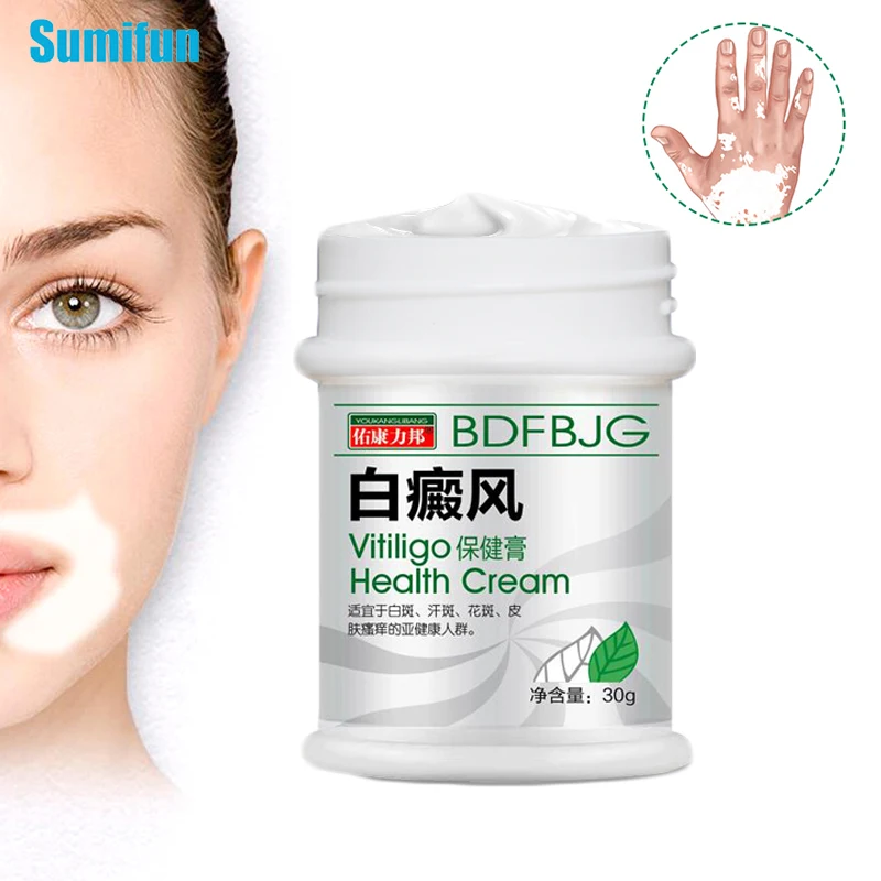 

30g Vitiligo Ointment Antibacterial Cream Psoriasis Localized White Spot Piebald Mycosis Leukoplakia Melanin Promoting Treatment