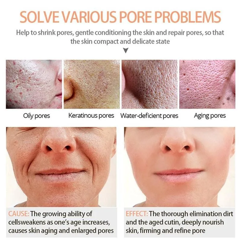 

Salicylic Acid Essence Moisturizing Shrink Pores Essence Face Skin Care Blackhead Removal Whitening Essence