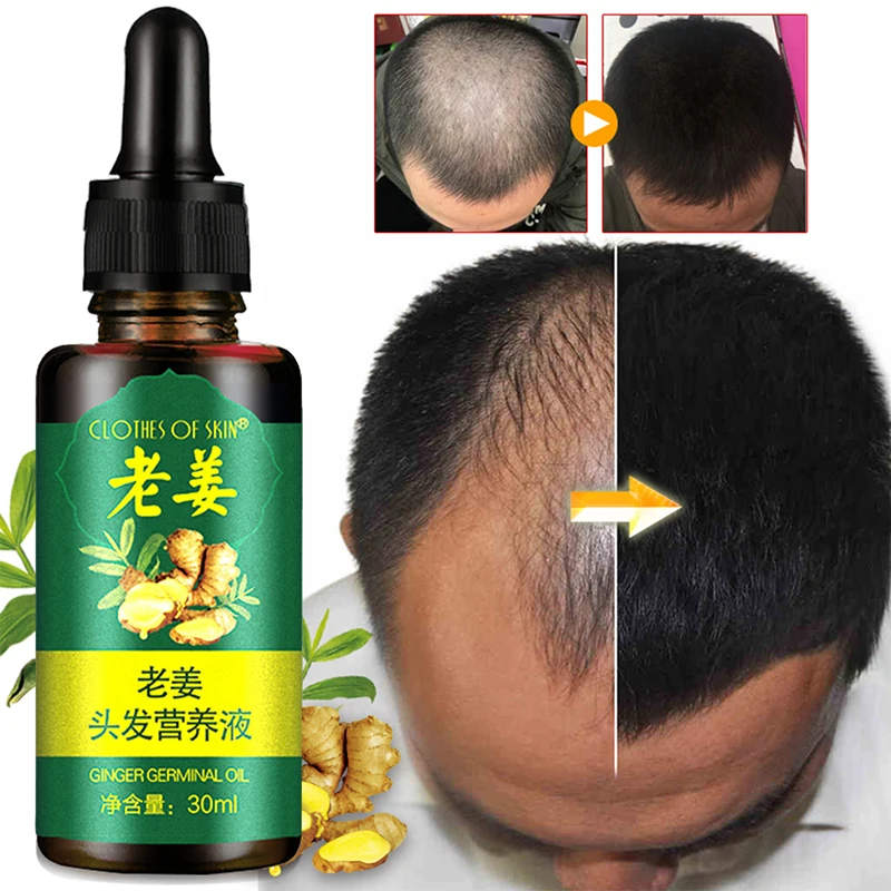 

10/30ml 7 Days Hair Loss Repair Damaged Hair Care Serum Old Ginger Fast Hair Growth Essence Oil Nourishing Soften Treatment