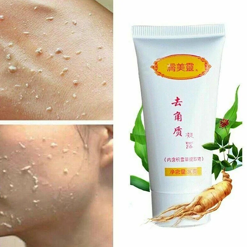 

Очищающий Отшелушивающий гель Centella Asia ca, питательные гиалуроновые скрабы, уход за омертвевшим кожей гелем
