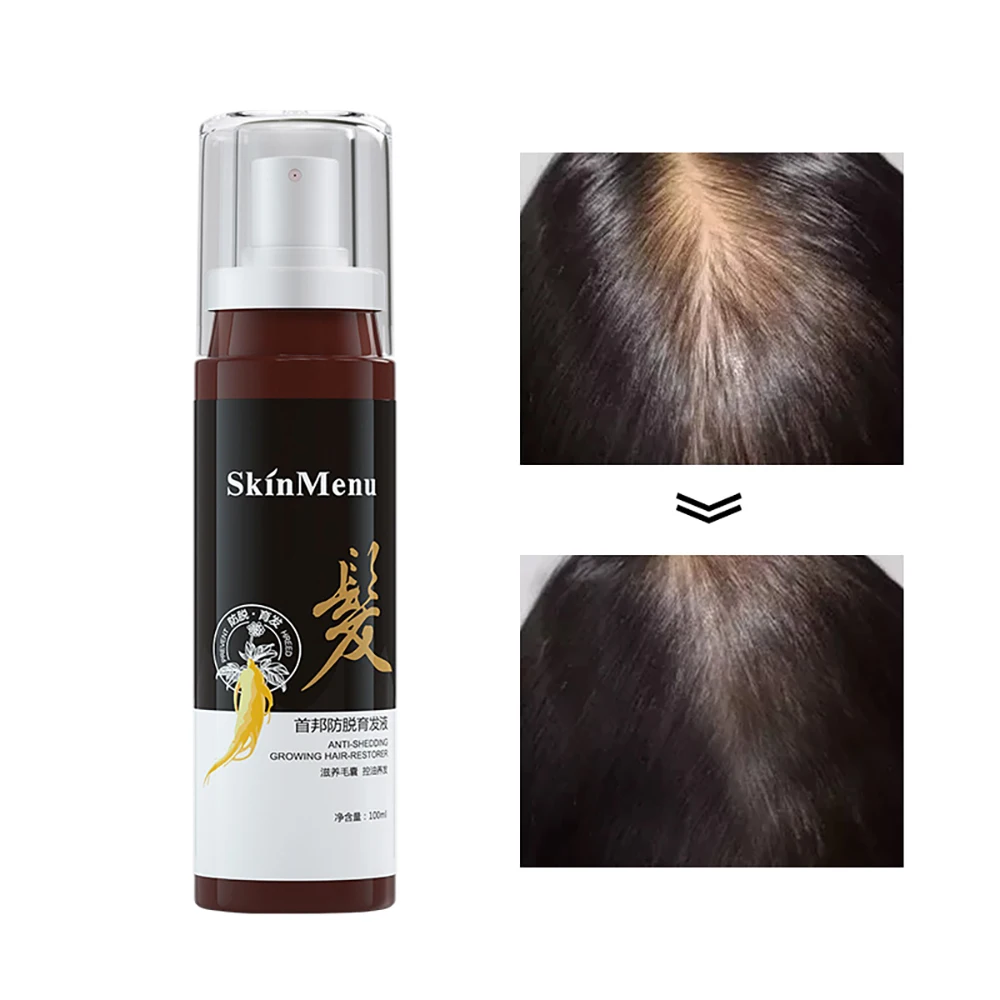 

Лосьон для роста волос Polygonum multiflorum для увеличения плотности волос и замедления роста спрея для волос 100 мл