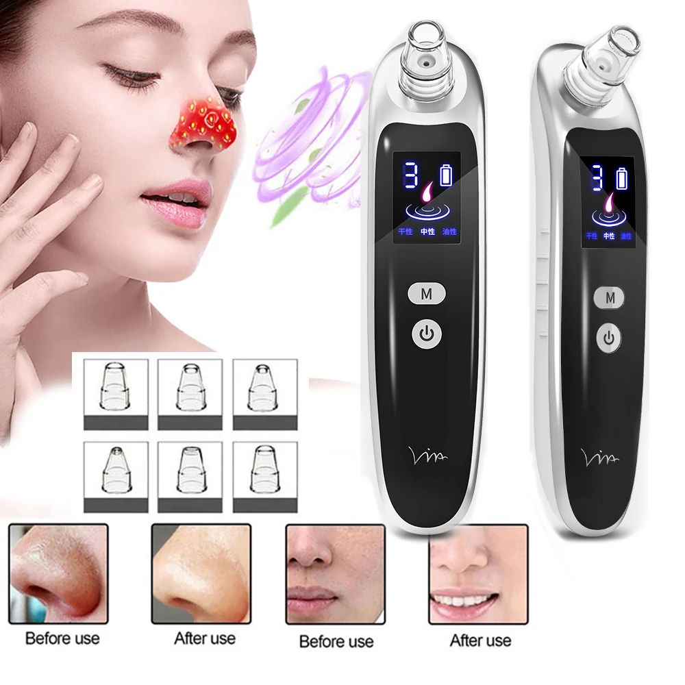 

LED Electric Blackhead Removal Beauty Instrument Vacuum Suction Face Pores Cleaning Device Blackhead Cleaner Nose AcneFacialCare