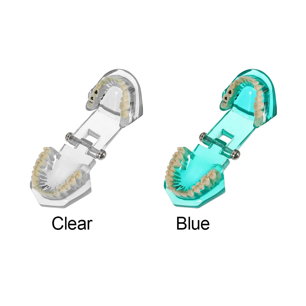 Ремонт стоматологического имплантата физический патологический уход за