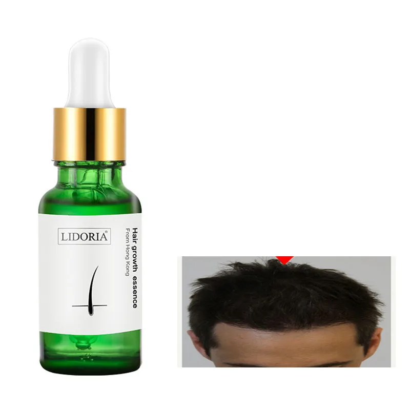 

Эссенция для роста волос Горячая Распродажа Shouwu, масло для выпадения волос, средство для лечения черных волос, густые волосы, уход за волоса...