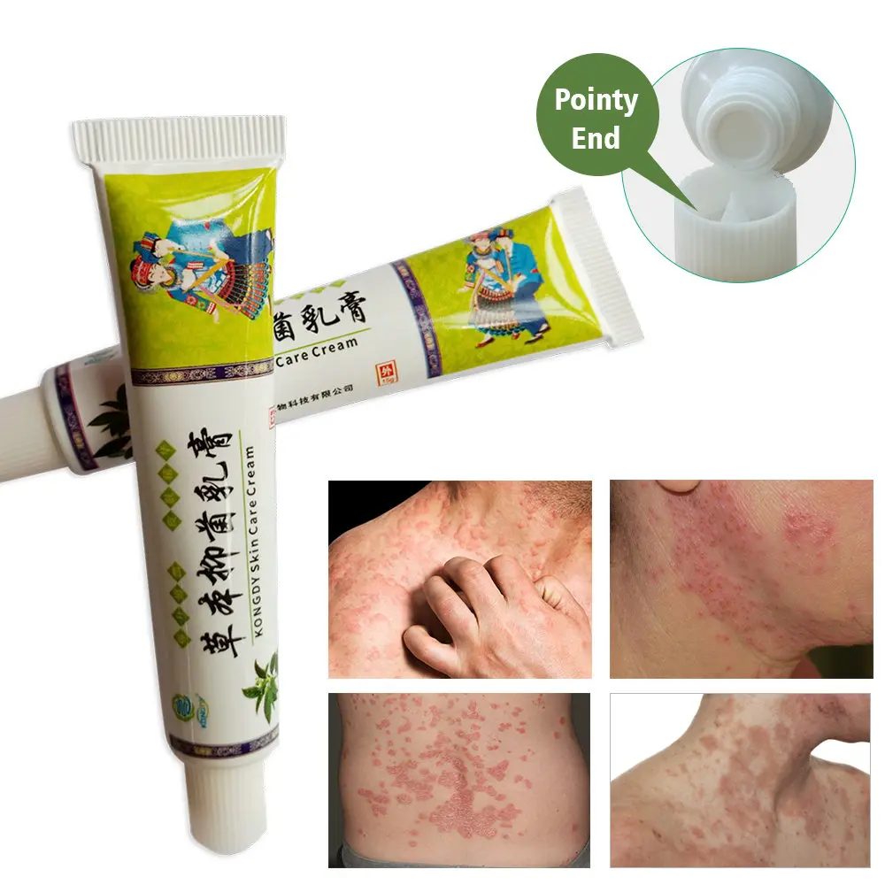 KONGDY крем для ухода за кожей китайская медицинская пластырь псориаз экзема мазь