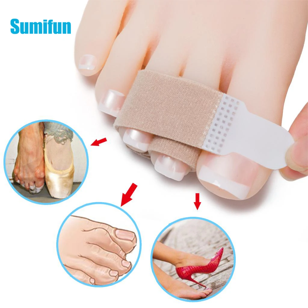 

10/12/16/20 шт., выпрямитель для пальцев ног