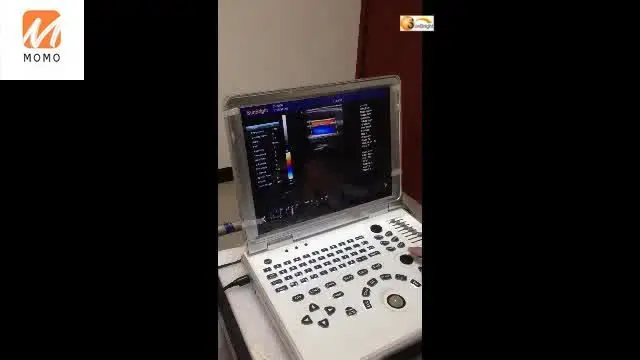 Ультразвуковое качество M5 3D 4D Цветной Допплер ультразвуковой допплер по цене 4d -