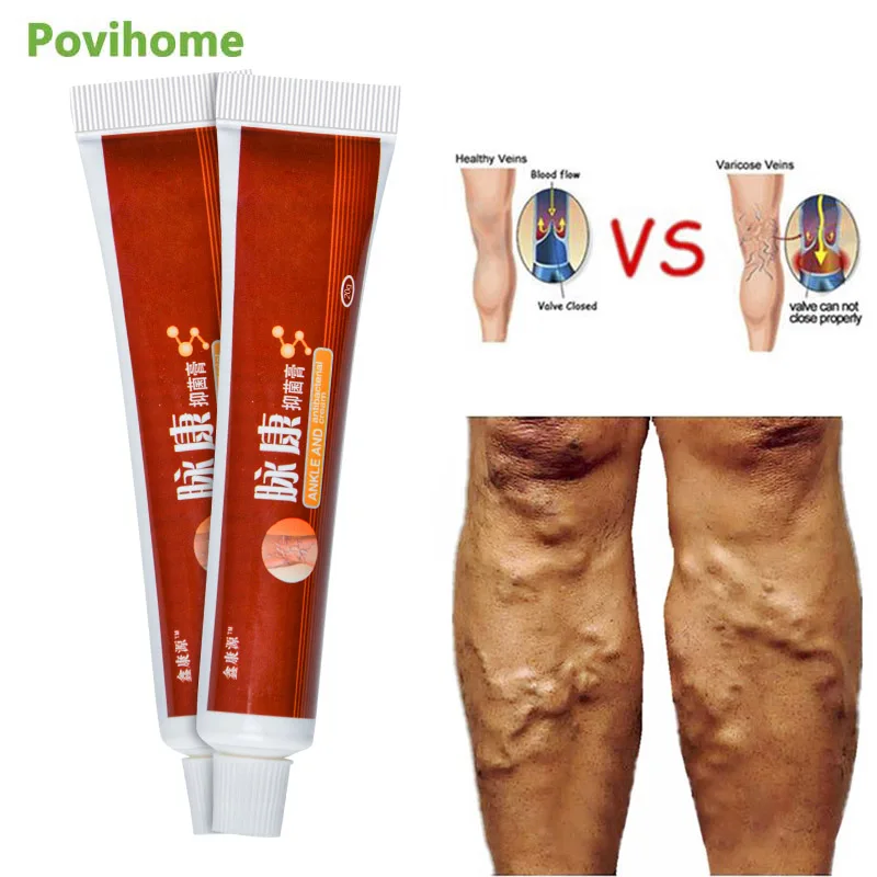 1 шт. мазь для лечения варикозного расширения вен 20 г|Пластыри терапевтические| |