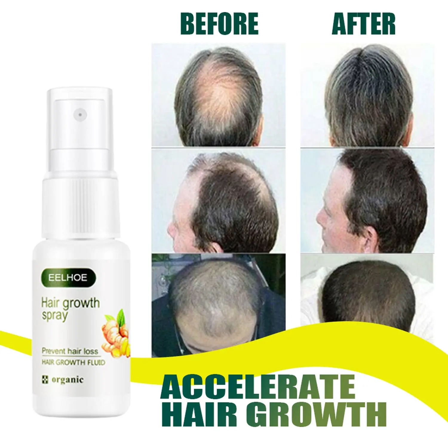 

Anti Hair Loss Regrowth Essence Plant Extract Series Ginger Hair Growth Spray Hair Care Germinal Dense Serum Pilatory