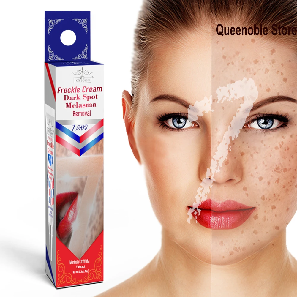 Мгновенное лечение крем для отбеливания веснушек лица мелазма удаления темных