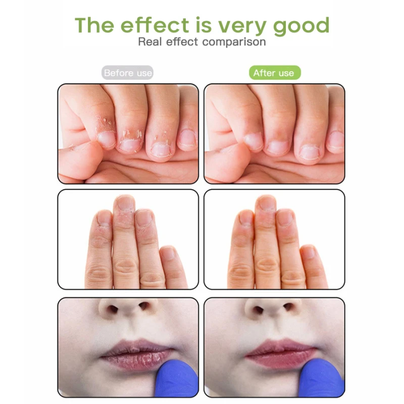 Детская горькая вода для ногтей детский гвоздь против укусов ручка Детский Малыш