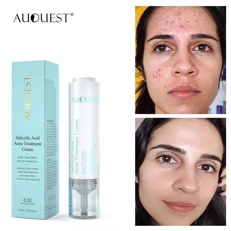 

Отбеливание акне увлажняющий крем против акне удаление черных точек салициловая кислота контроль жирности сужение пор Корейская Косметик...