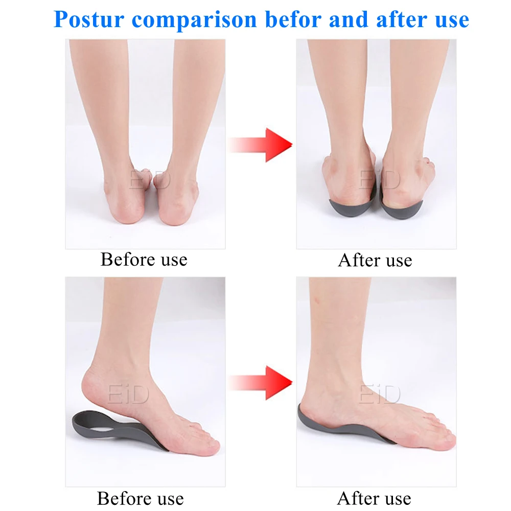 XO-Legs Orthopedic Insoles Orthotics Flat Foot Health Sole Pad For Shoes Insert Arch Support Pad For Plantar fasciitis Feet Care