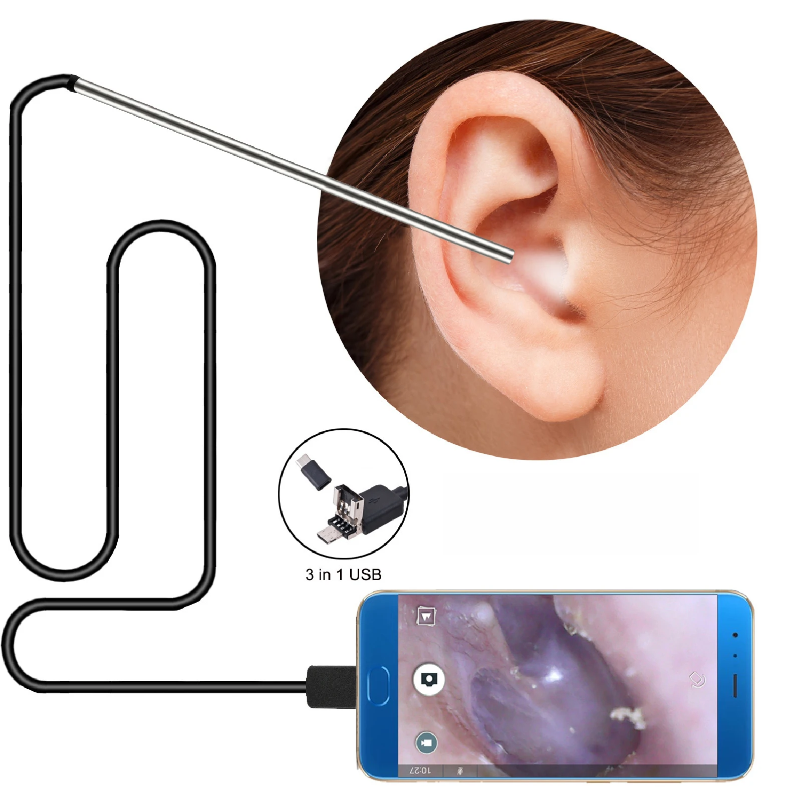 

Earwax Removal Tool Waterproof HD Vision Mini Camera Ear Cleaning Endoscope Kit Adults Waterproof Earwax Removal Tool Android