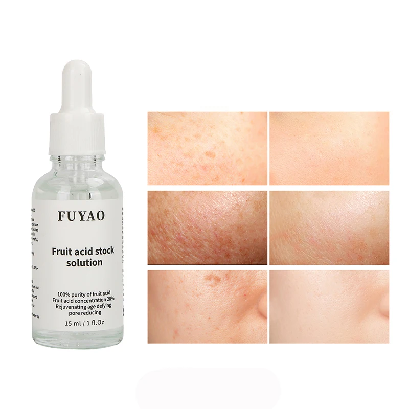 Гликолевая кислота 100% для очистки кожи химическая очистка лечение акне