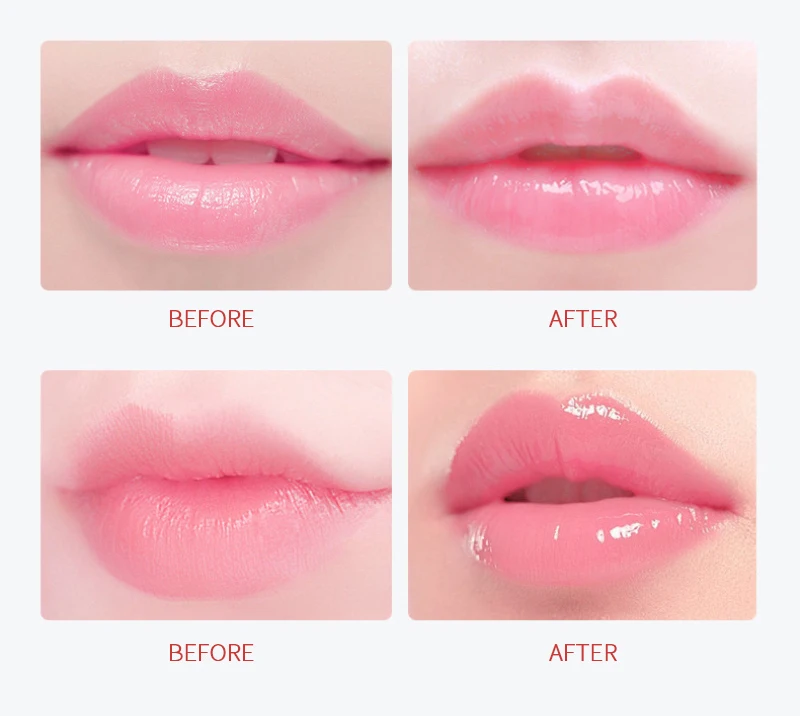

20pcs/box Lips Care Mask Cherry Hydrating Moisturizing Nourishing Lip Mask Anti-Drying Diminishing Lip Lines Improving Mask