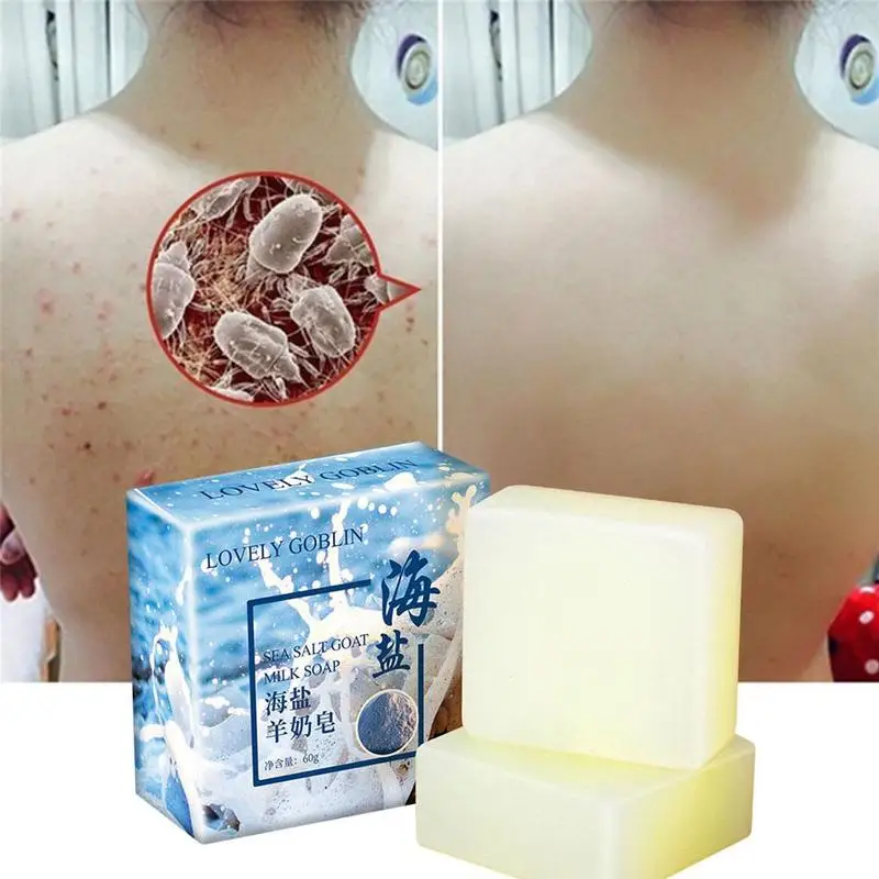 Goat Milk Sea Salt Soap Remove Pimple Pores Acne Treatment Base Tools Wash Care Cleanser Soap Face Moisturizing Skin C5Y2