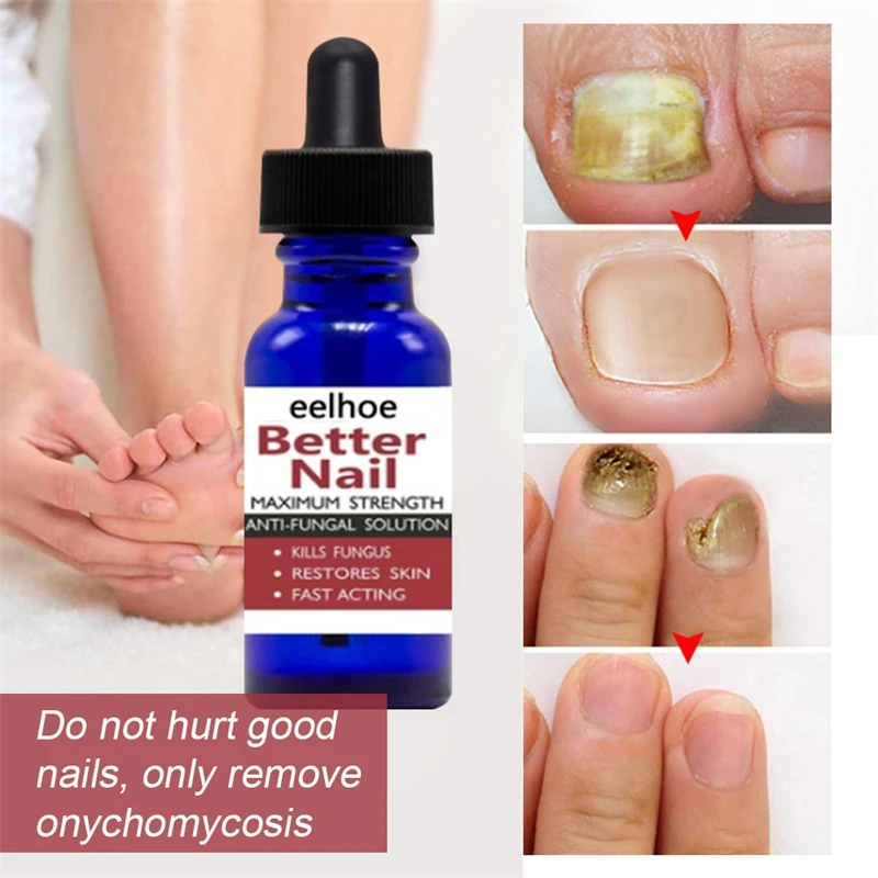 

Nail Repair Nail Bacteria Care Feet Hands Nails Polish Liquid