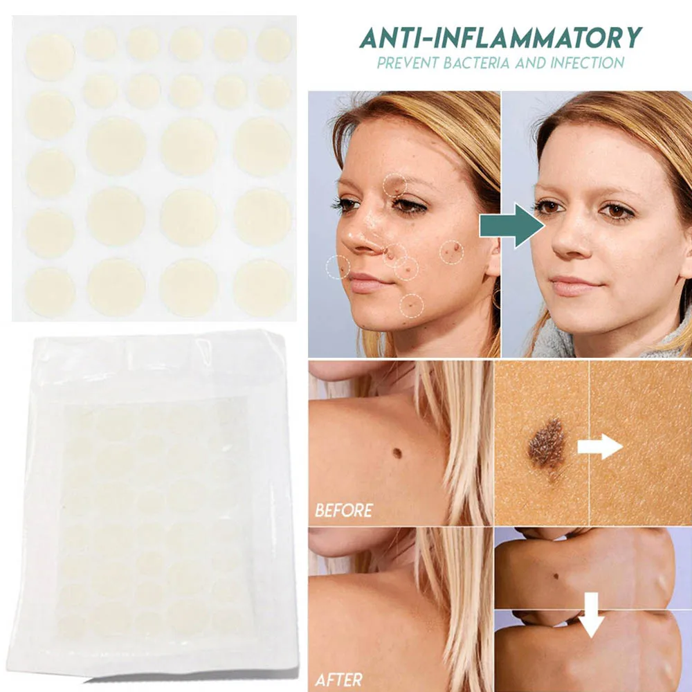Skin Tag Remover Patch Ance Pimple Plaster Acne Cream Invisible Hydrocolloid Master Anti-infection Absorb Face Care |