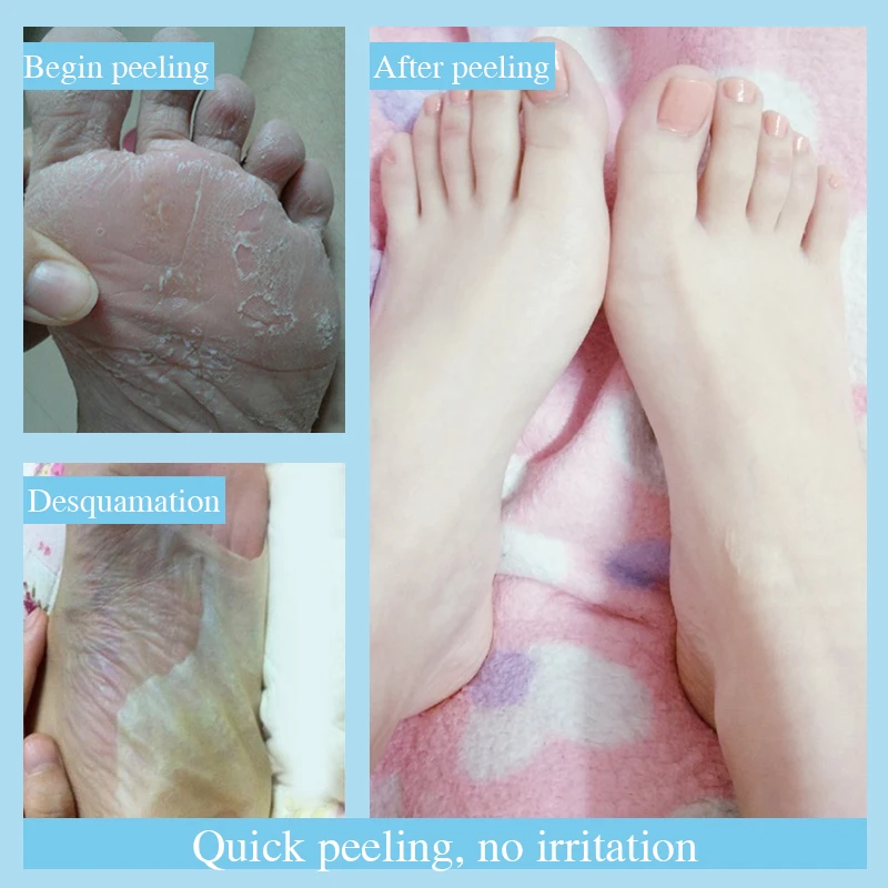 Кожа для ног отшелушивающая маска удаления омертвевшей кожи|Стопы| |