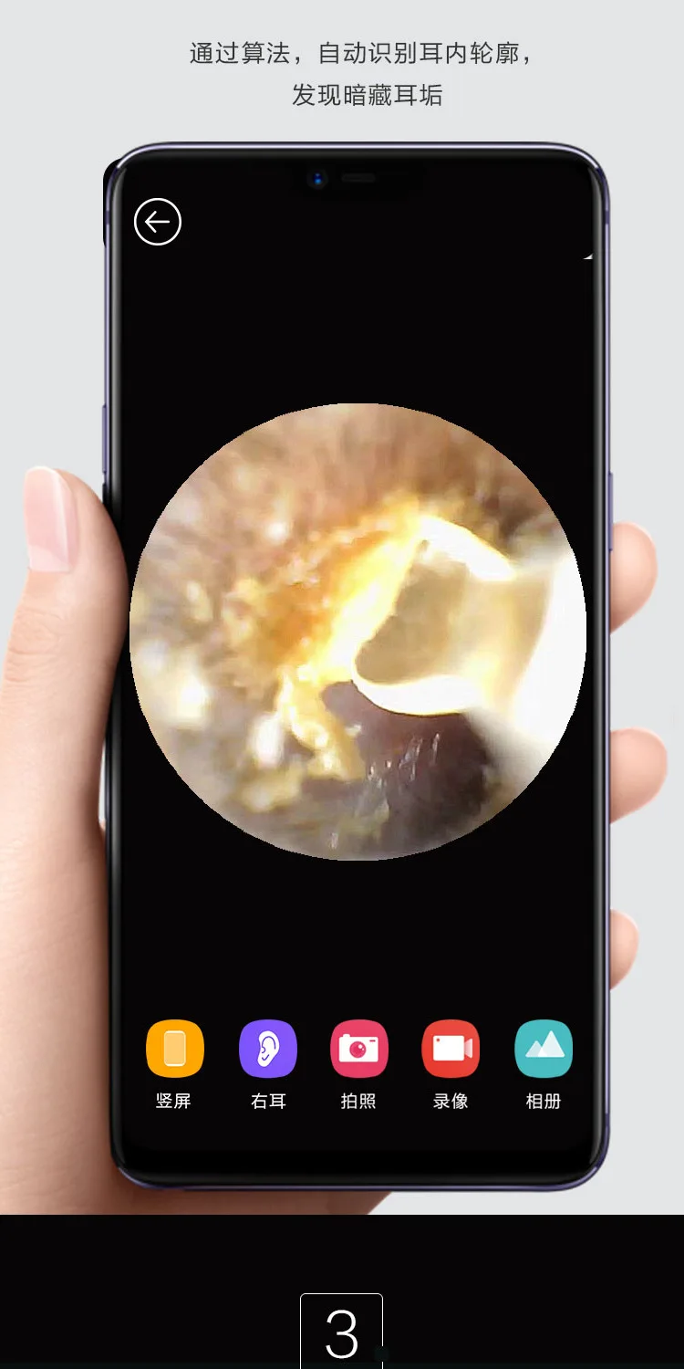 WiFi отоскоп визуальный очиститель ушей с беспроводным адаптером инструмент для